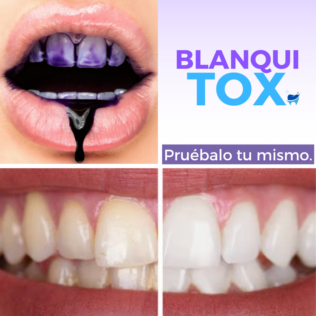 Blanquitox - Gel blanqueador dental